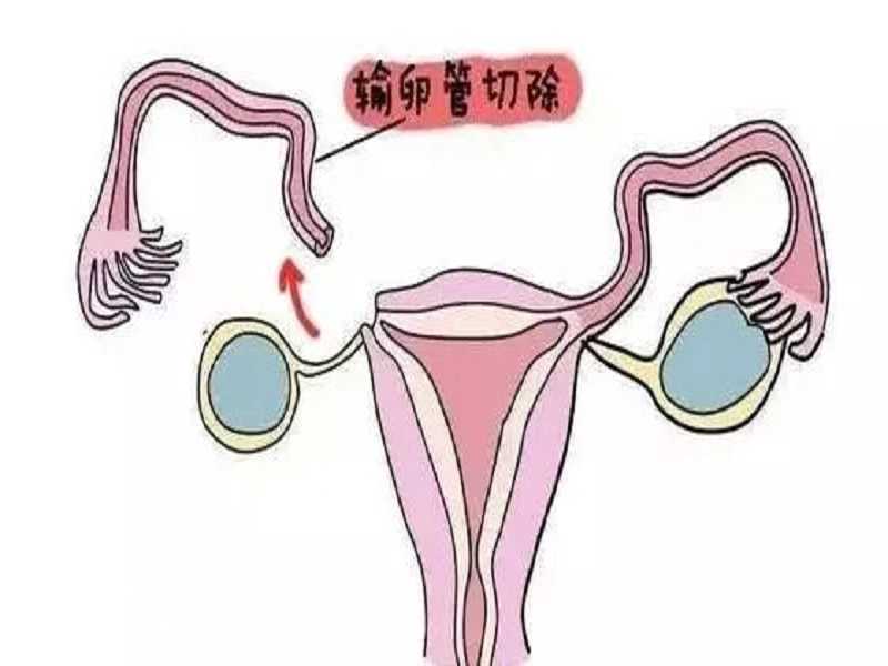 广州供卵试管医院哪个好,供卵辅助生殖哪个医院