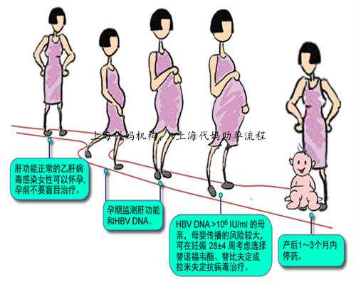 上海代妈机构， 上海代妈助孕流程