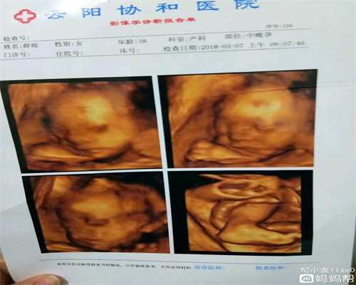 广州代孕包成功哪家好,广州代孕前的一些检查