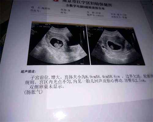 广州代孕选性别包成功可信吗,女性子宫发育异常