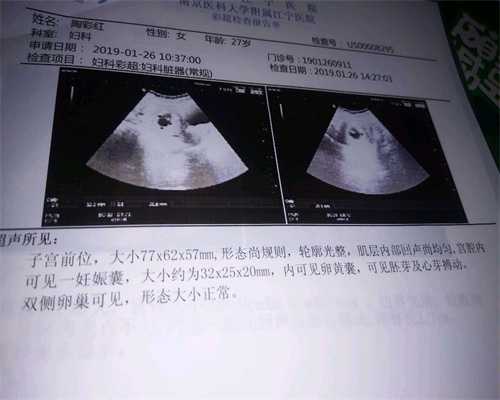 广州代孕妈妈需要多少钱,增加怀孕的方法，你可