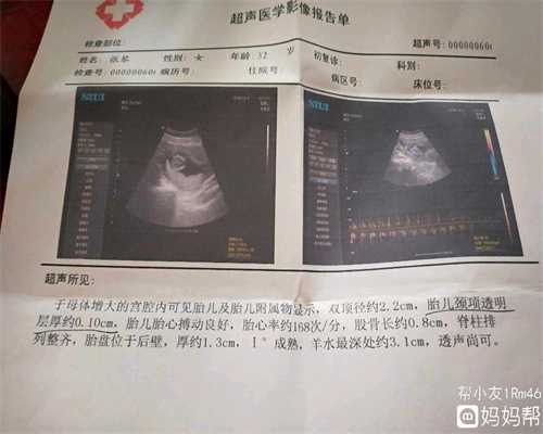 找亲戚广州代孕试管婴儿,激素六项在试管婴儿过