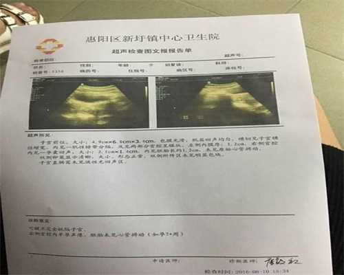 广州人工受孕的费用多少钱~广州找女人代生孩子