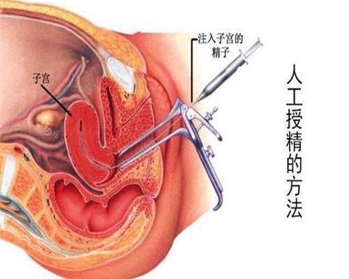 广州代孕~广州到哪找代孕~广州最好的代孕产子公司