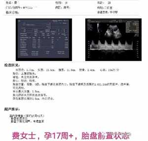 广州代孕正规机构，广州做试管婴儿费用是多少钱？广州试管费用！